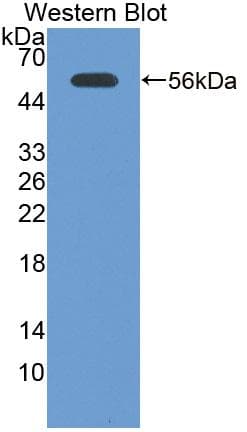 LAMC2 / Laminin Gamma 2 Antibody (aa187-415)