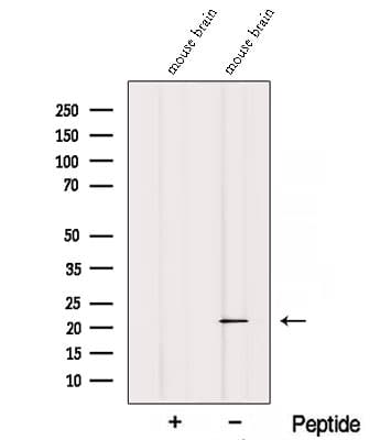 REEP1 Antibody