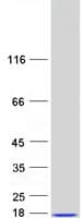 Human MYCBP Protein (Recombinant Myc-DDK (Flag))