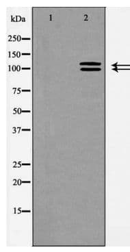 Polyclonal Rabbit anti-Human ACE2 / ACE-2 Antibody (WB)
