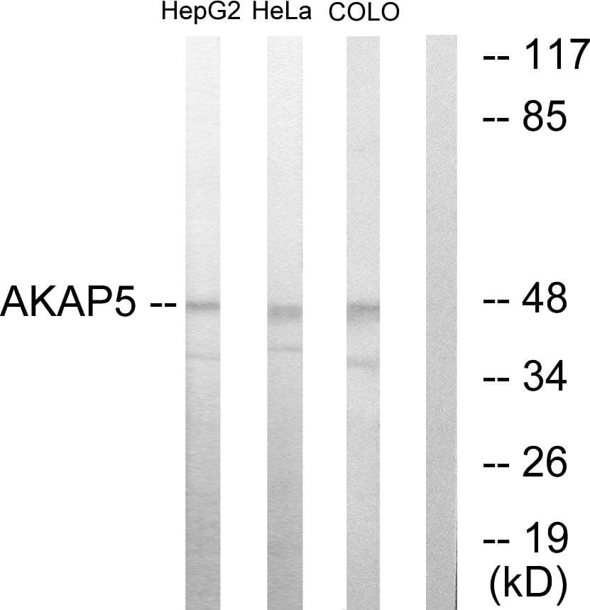 AKAP5 / AKAP79 Antibody