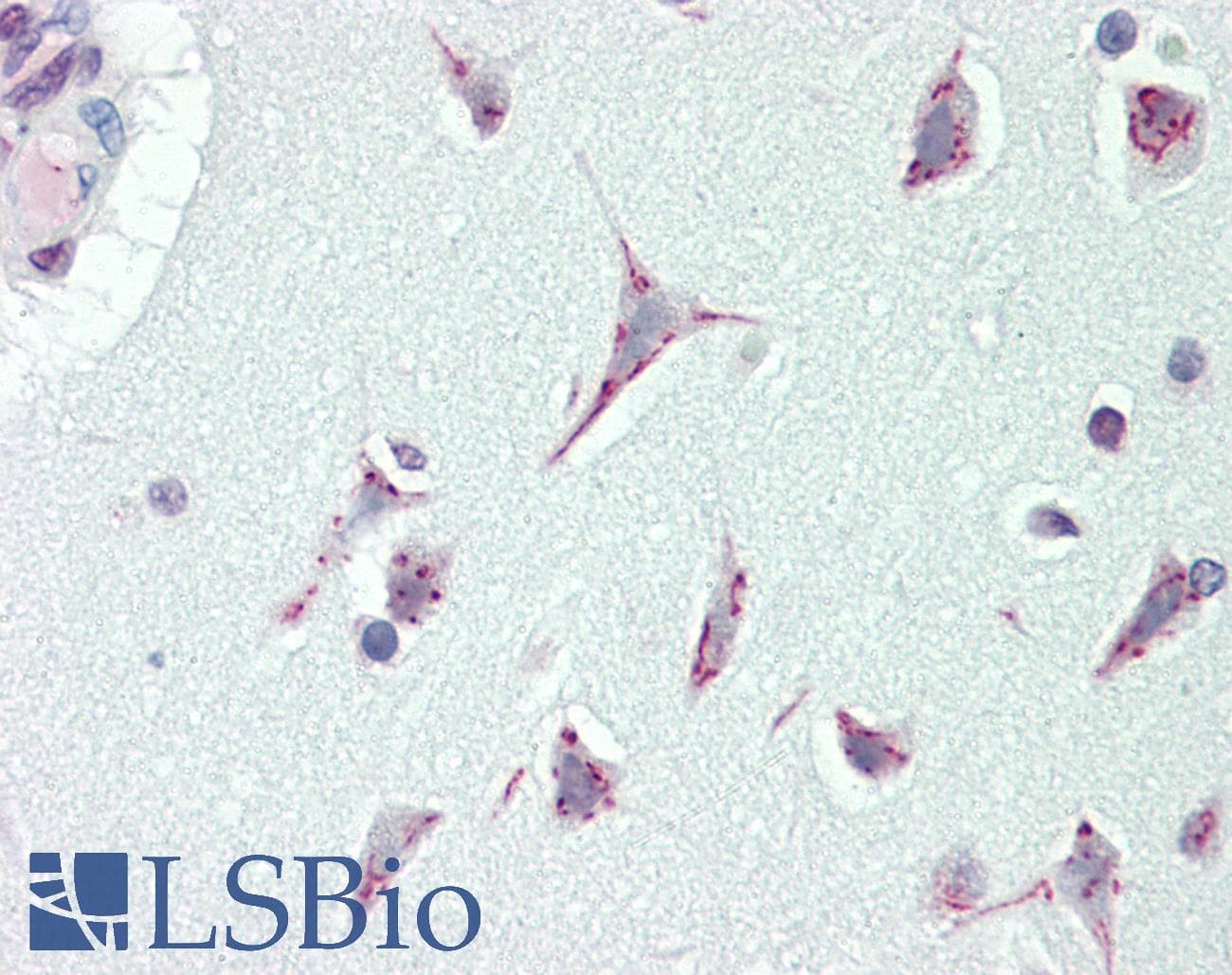 IHC-plus™ CASC4 Antibody (aa336-365)