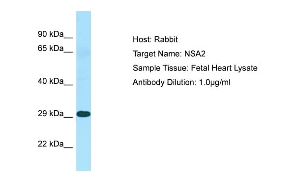 Hypothetical Protein / TINP1 Antibody (N-Terminus)