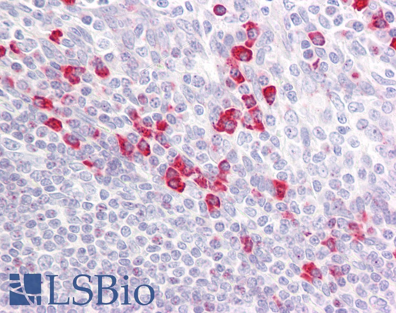 IHC-plus™ Polyclonal Rabbit anti-Human PAK1 + PAK2 + PAK3 Antibody (aa391-440, IHC, WB)