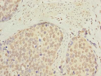 SLC22A18AS Antibody