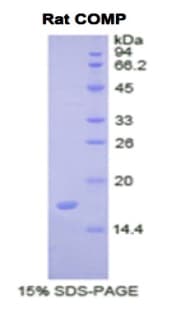 Rat COMP / THBS5 Protein (Recombinant His)