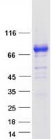 Human SPHK2 Protein (Recombinant Myc-DDK (Flag))