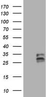 CD99 Antibody (clone OTI5C1)
