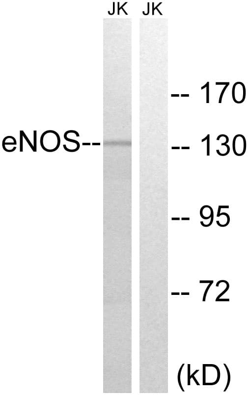NOS3 / eNOS Antibody (aa1144-1193)