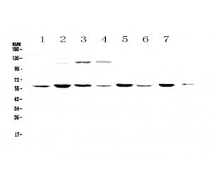 Polyclonal Rabbit anti-Human CHRNA3 Antibody (IHC, WB)