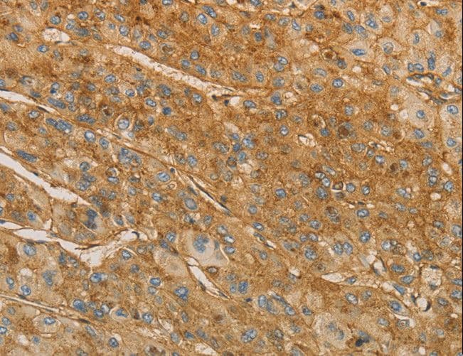 Polyclonal Rabbit anti-Human VTN / Vitronectin Antibody (IHC)
