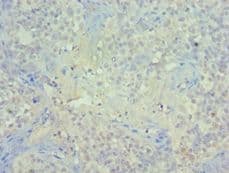 Polyclonal Rabbit anti-Human PIAS1 Antibody (aa422-651, IHC)