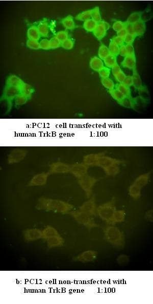 Polyclonal Rabbit anti-Human NTRK2 / TRKB Antibody (C-Terminus, IF)