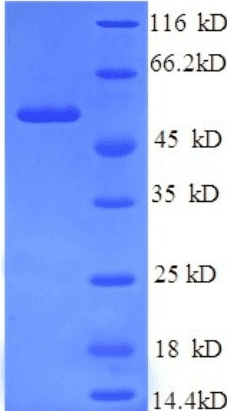 Human Tyrosinase Protein (Recombinant 6His, N-terminus)