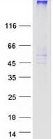 Human TM9SF1 Protein (Recombinant Myc-DDK (Flag))