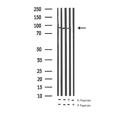RPS6KA5 / MSK1 Antibody (phospho-Ser376)