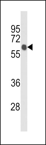 ANKRD13C Antibody (aa1-30)
