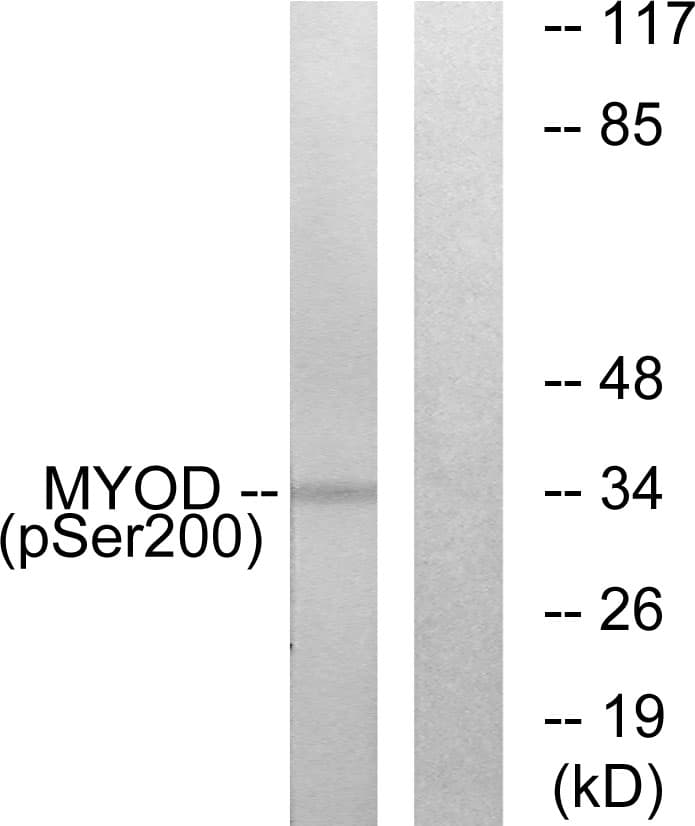 MYOD / MYOD1 Antibody (phospho-Ser200)