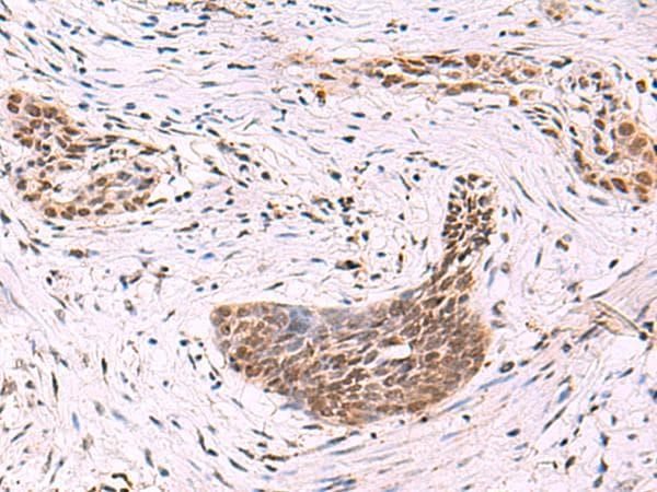 Polyclonal Rabbit anti-Human CREBBP / CREB Binding Protein Antibody (IHC)