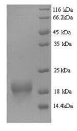 Mouse FHIT Protein (Recombinant 6His, N-terminus)