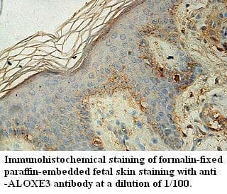 ALOXE3 Antibody (aa334-599)