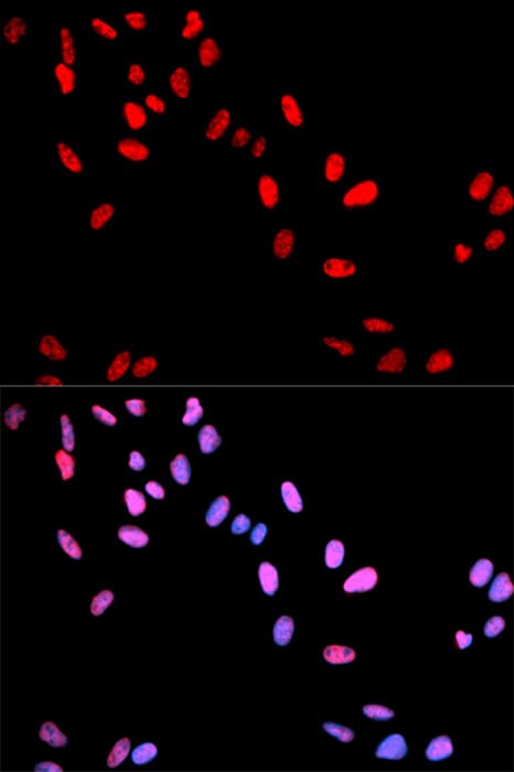 MYC / c-Myc Antibody (phospho-Thr58)