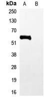 His Tag Antibody
