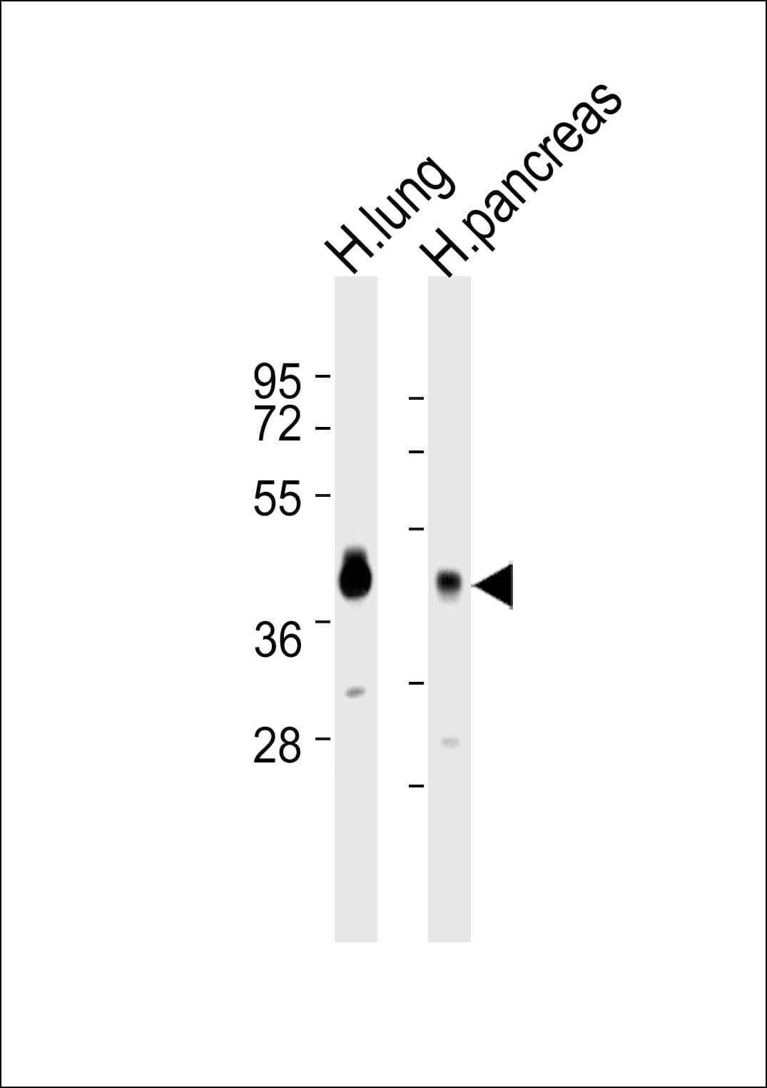 Polyclonal Rabbit anti-Human APOL2 / Apolipoprotein L 2 Antibody (WB)