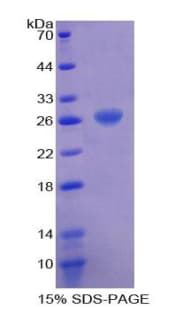 Human MYH1 Protein (Recombinant His-T7)