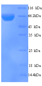 Human EIF2AK2 / PKR Protein (Recombinant 6His, N-terminus)