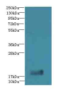 Polyclonal Rabbit anti-Human TPPP2 Antibody (IHC, WB)