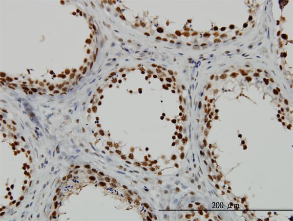 IHC-plus™ RAD18 Antibody (clone 3H7)