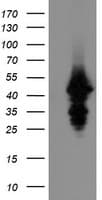 UBE2J1 Antibody (clone OTI3D1)