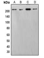 SMARCA2 / BRM Antibody (Internal)