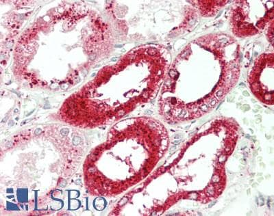 PathPlus™ CTSD / Cathepsin D Antibody (Internal)