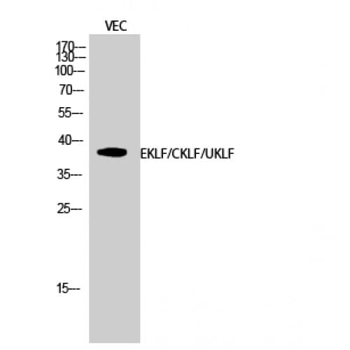 EKLF / KLF1 Antibody (280-360 aa, C-terminal)