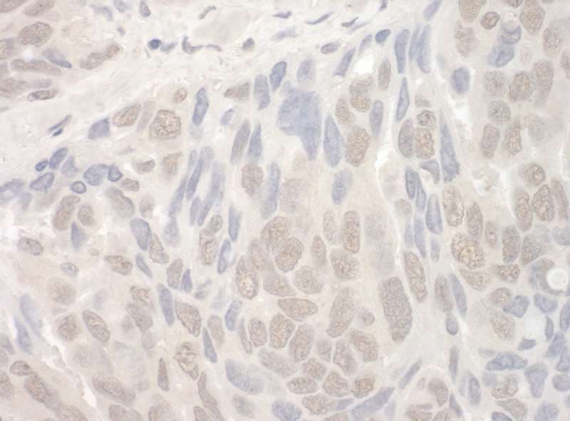 THOC2 Antibody (aa1400-1450)