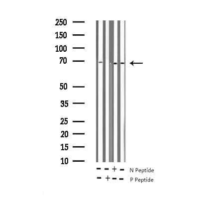 Polyclonal Rabbit anti-Human RELA / NFKB p65 Antibody (phospho-Thr435, IHC, IF, WB)