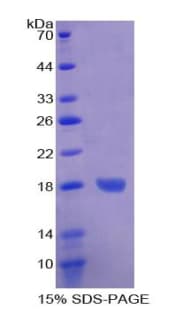 Bovine FABP3 / H-FABP Protein (Recombinant His-T7)