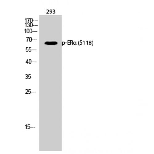 ER Alpha / Estrogen Receptor Antibody (60-140 aa)