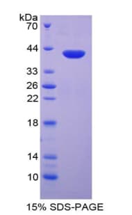 Rat CCL3 / MIP-1-Alpha Protein (Recombinant His-GST)