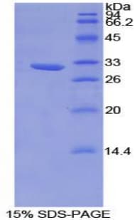 Rat HAO1 Protein (Recombinant His-T7)
