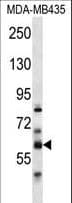 PTDSS2 Antibody (aa1-30)