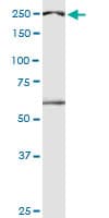 DATF1 / DIDO1 Antibody (clone 3B1)