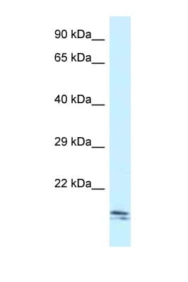 SEC11C Antibody (aa107-156)