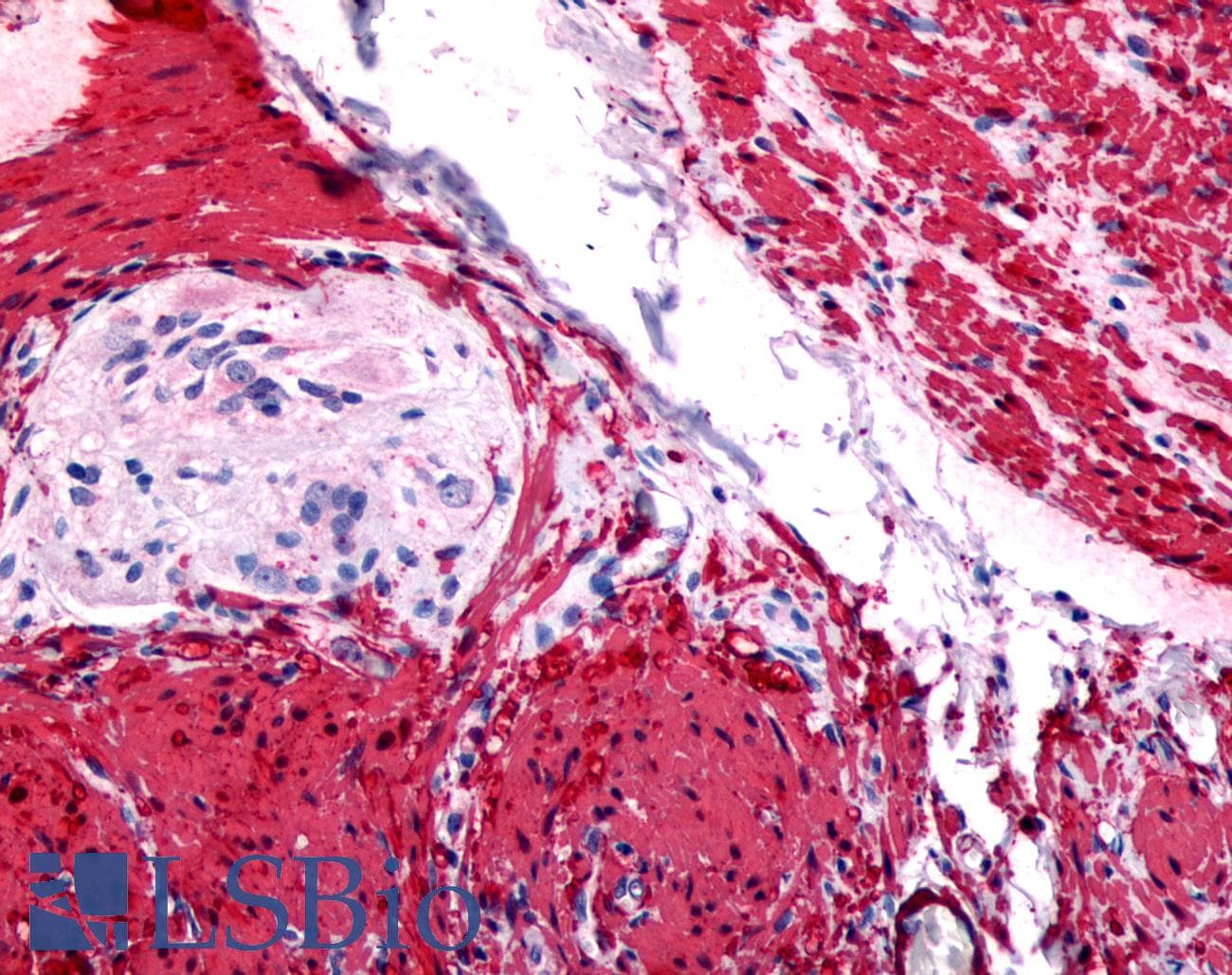 IHC-plus™ Polyclonal Rabbit anti-Human GRPR Antibody (Cytoplasmic Domain, IHC)