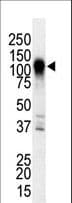 Polyclonal Rabbit anti-Human MAP3K6 / MEKK6 Antibody (aa1028-1058, IHC, WB)