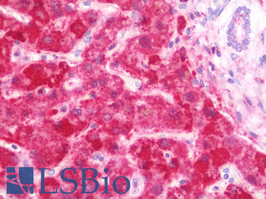IHC-plus™ FH / Fumarase / MCL Antibody (aa195-473)