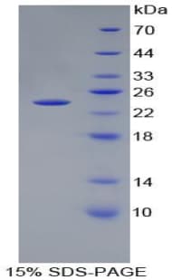 Human PGLYRP1 / PGRP Protein (Recombinant His, N-Terminal)