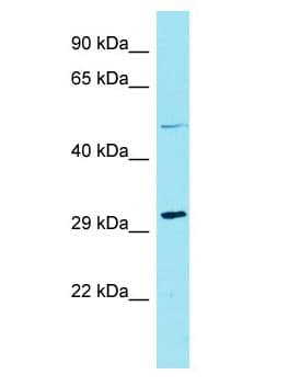 HENMT1 Antibody (aa21-70)